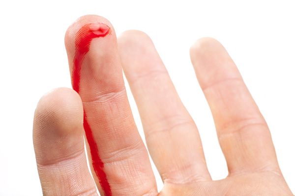 first-aid-training-bleeding-finger